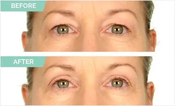 Riafu New Glue-Free Ultra Natural Invisible Double Eyelid Sticker