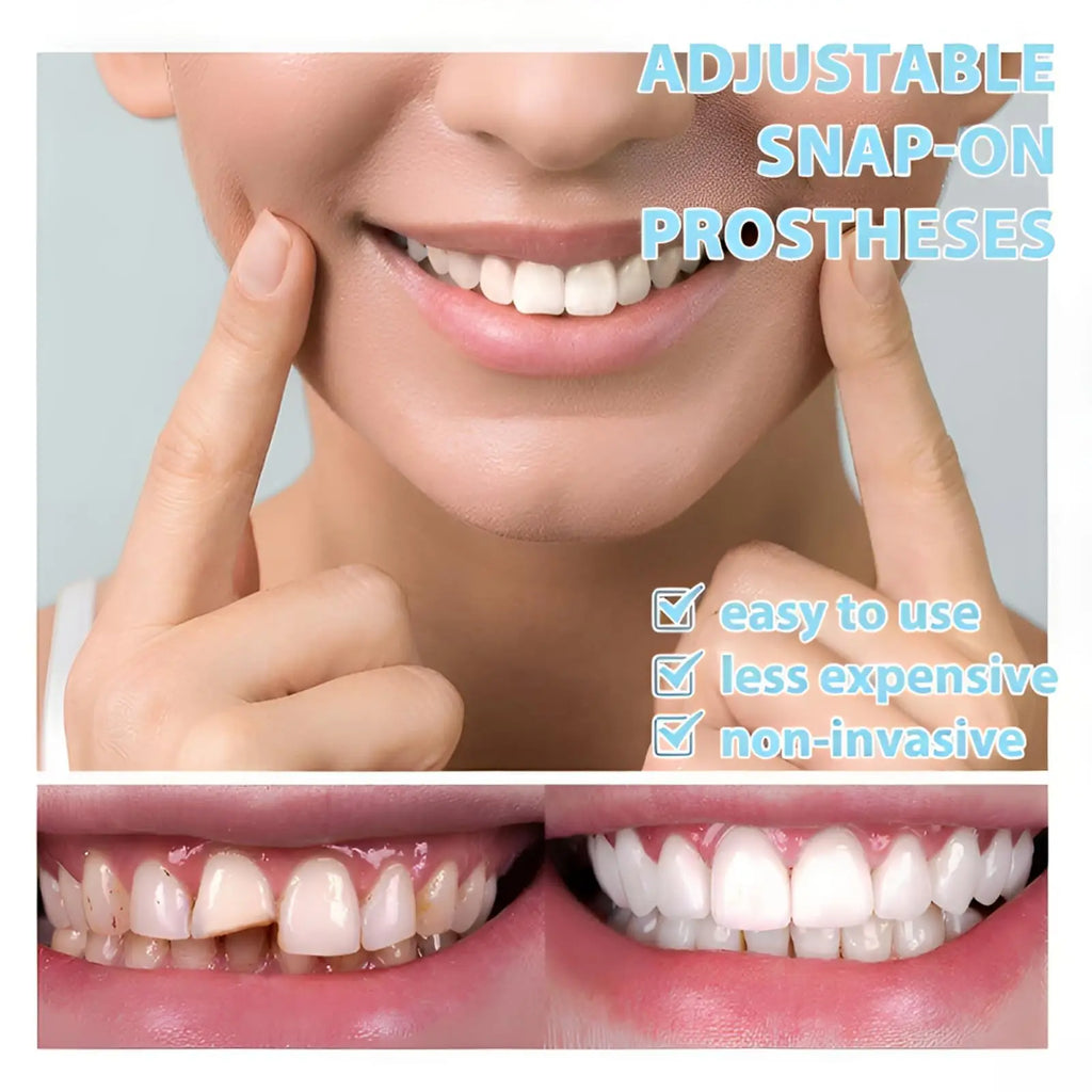 Instant Adjustable Snap-On Denture Kit | Medical-Grade Invisible Teeth for Gap Repair & Temporary Crowns