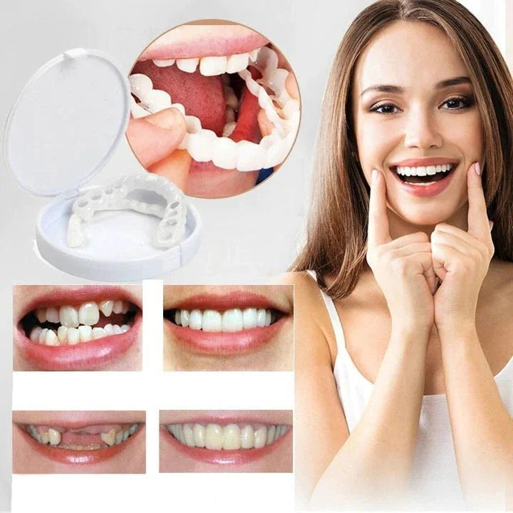 Riafu – Snap-On Veneers Set for Upper & Lower Teeth with Custom Fit | Removable Solution for a Natural-Looking Smile