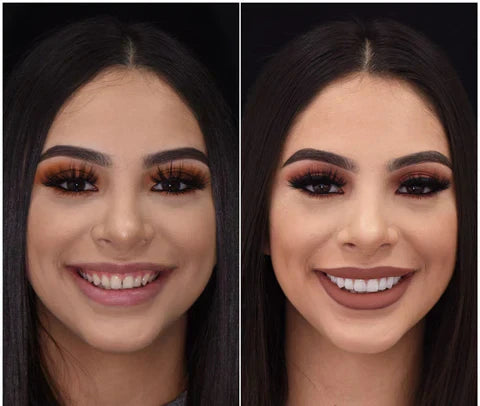 Riafu – Snap-On Veneers Set for Upper & Lower Teeth with Custom Fit | Removable Solution for a Natural-Looking Smile